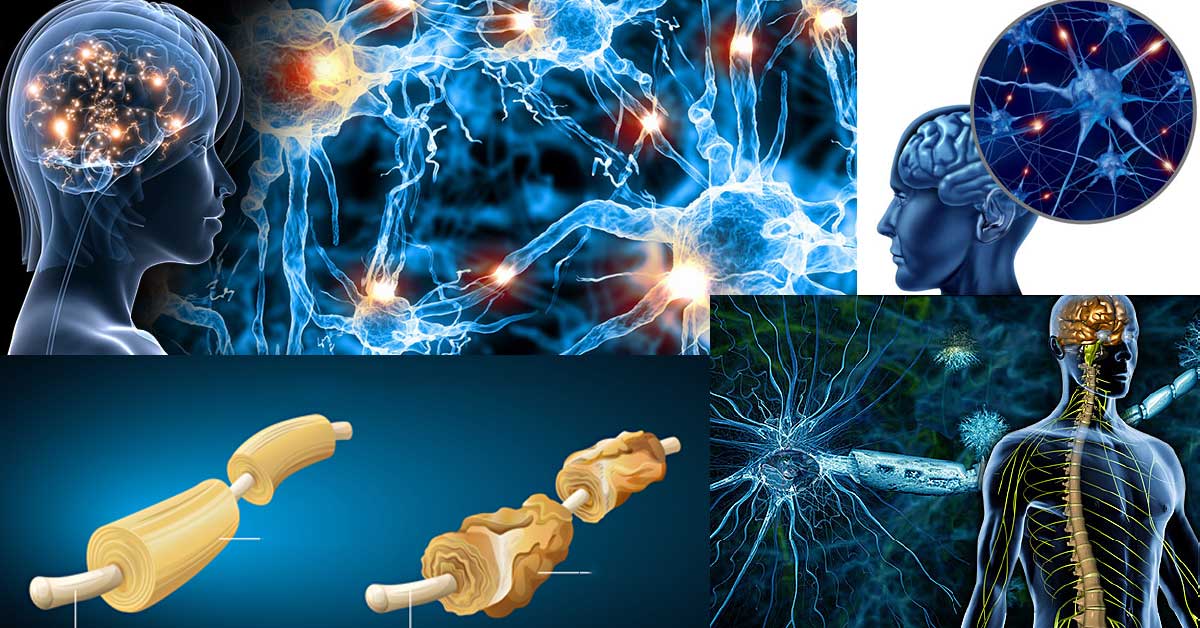 Дисеминирана, мултипленна или множествена склероза