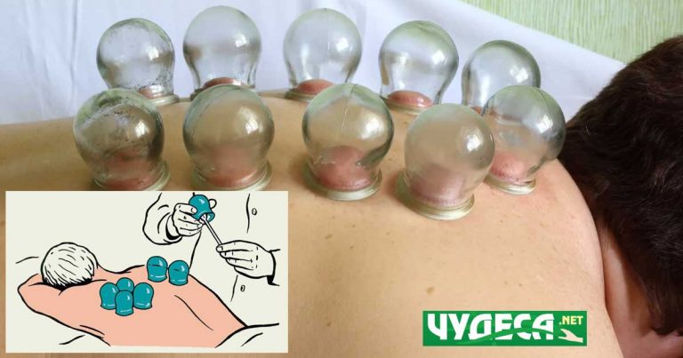 точки за поставяне на вендузи