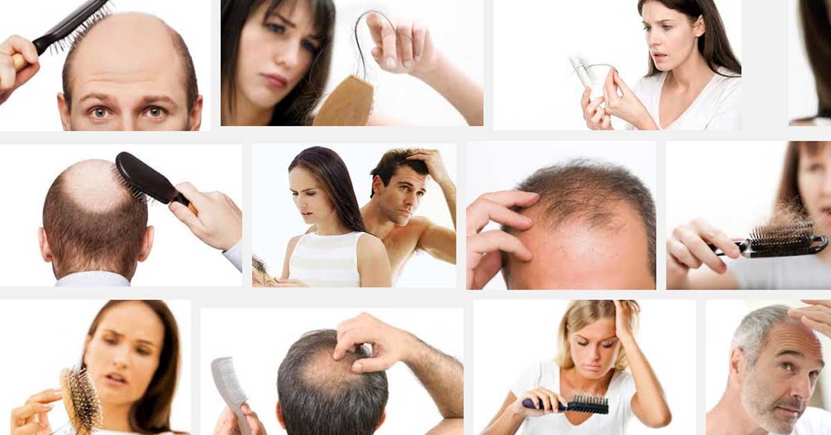 падане на коса капене опадане косопад