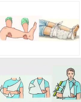 синини по тялото