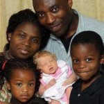 Албиносче 228x300