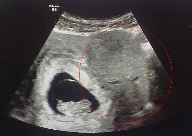 Ликът на ангела