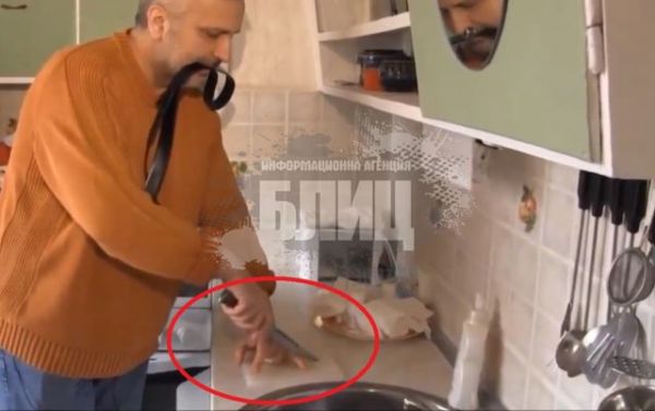 Ивайло си реже пръста