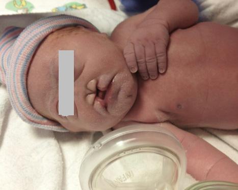 Лечение на вродени малформации