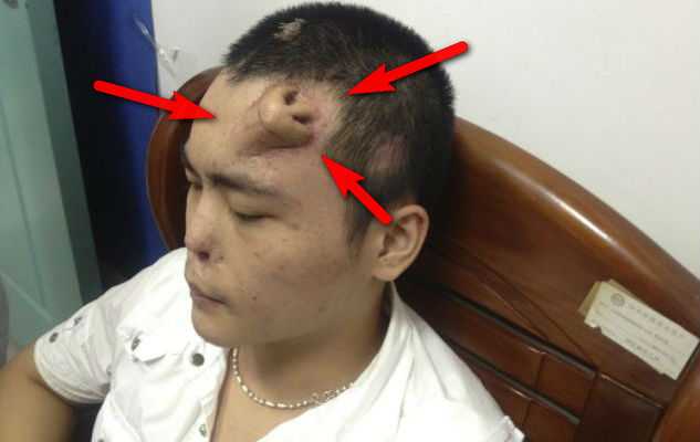 Нос поникна на челото