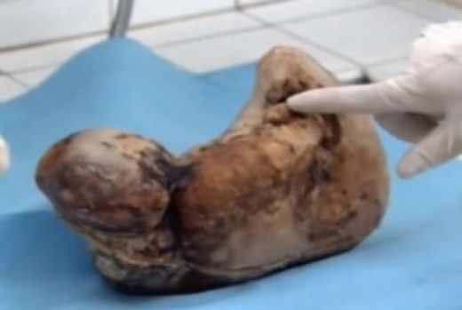 Захра роди своето бебе след 46 години бременност