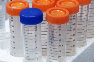 Българи създадоха чудодейно лекарство срещу тумори! 2 БГ учени откриха как да лекуват рак