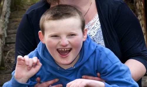 синдром на Ангелман