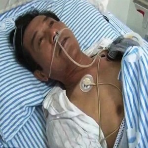 Китаец живя 40 години с неподозирана находка в тялото си 2 тялото