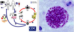 toxoplasmosis токсоплазмоза симптоми лечение билки 03