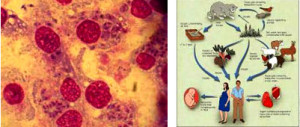 toxoplasmosis токсоплазмоза симптоми лечение билки 02
