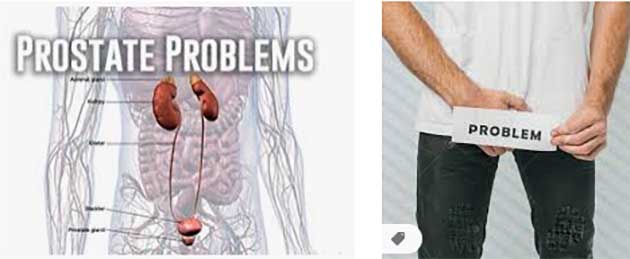 problemi-s-prostatata-02