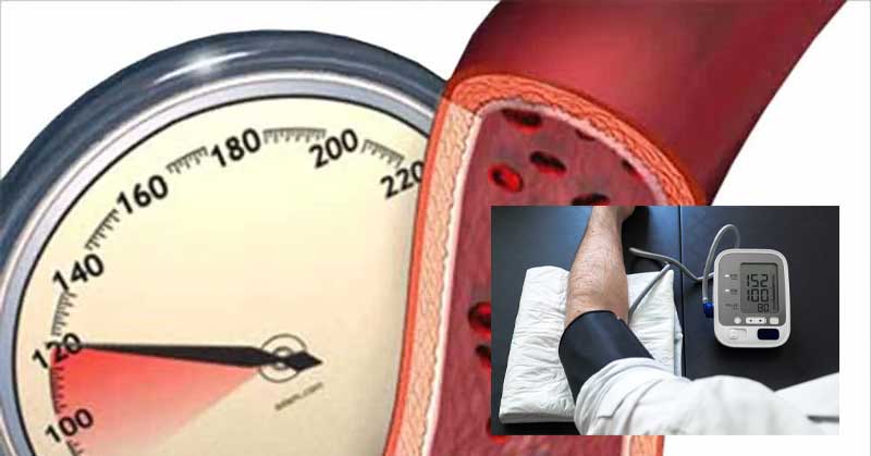 Високо кръвно 02 visoko-kravno-03