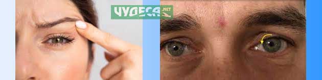 Играе ми лявото око. трептене на лявото око